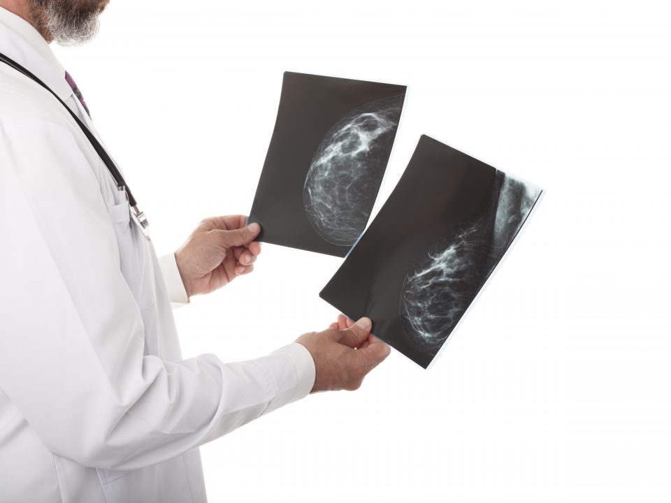 mamografia digital e convencional